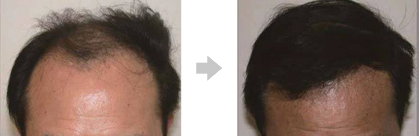 abaee98629fad028d1f493ae3b1a6717_1738142157_7299.png